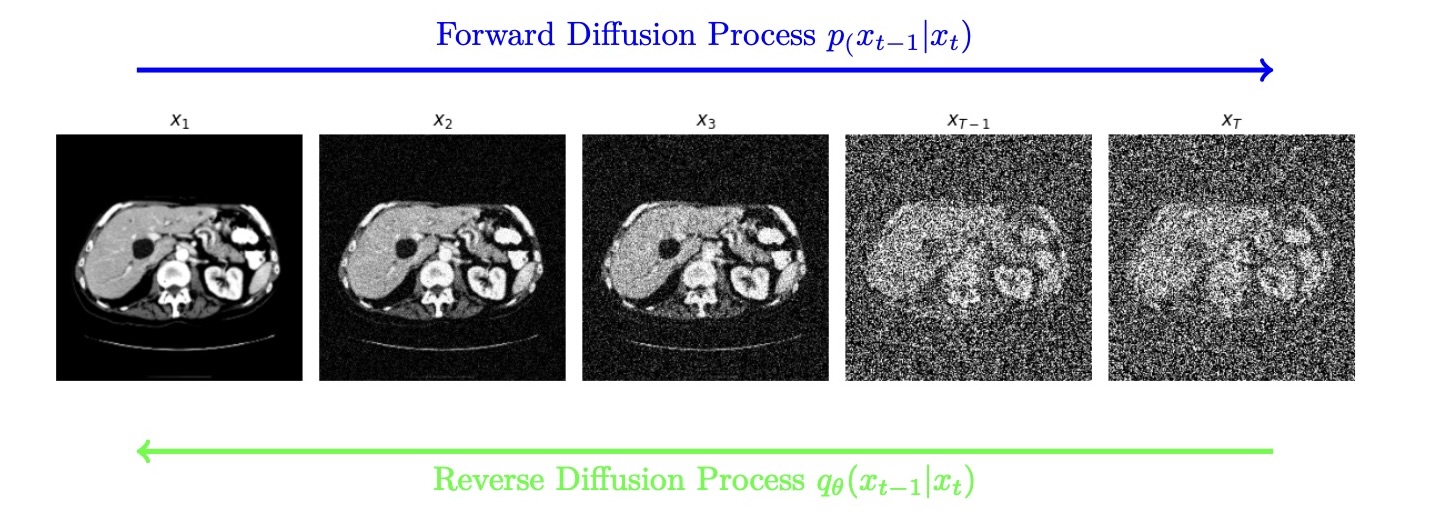 PET Attenuation and 
Scatter Correction using Diffusion Model